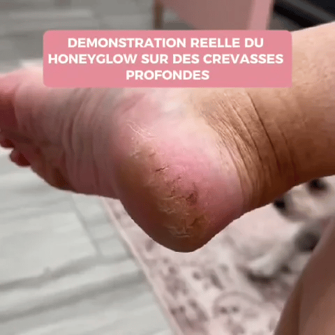 HoneyGlow™ – Kit Beauté Pieds