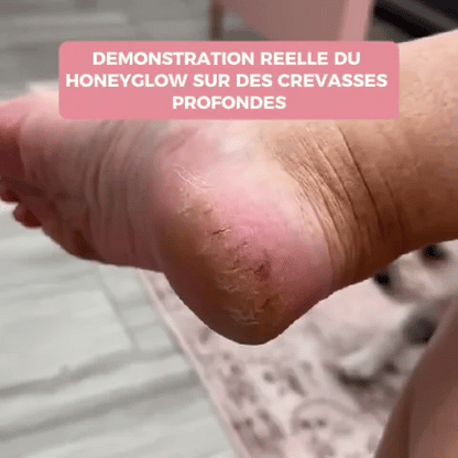 HoneyGlow™ – Kit Beauté Pieds